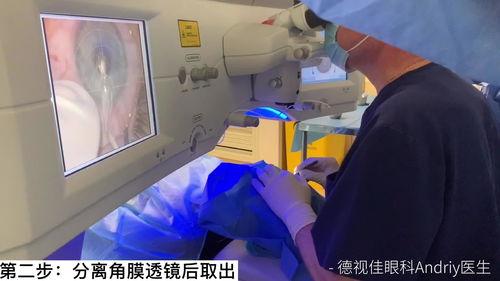 飞秒手术视频,揭秘精准视觉矫正的神奇之旅
