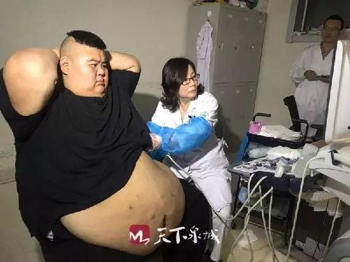 肥胖视频,视频揭示健康危机背后的真相
