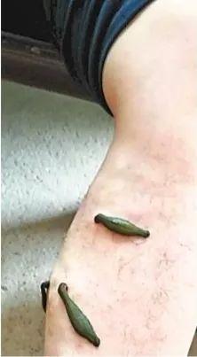 蚂蝗吸血视频,惊心动魄的生存法则