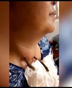 蚂蝗吸血视频,惊心动魄的生存法则