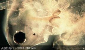 恐怖手术视频,惊心动魄的医学瞬间