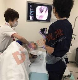 肠镜过程视频,直观体验，轻松了解